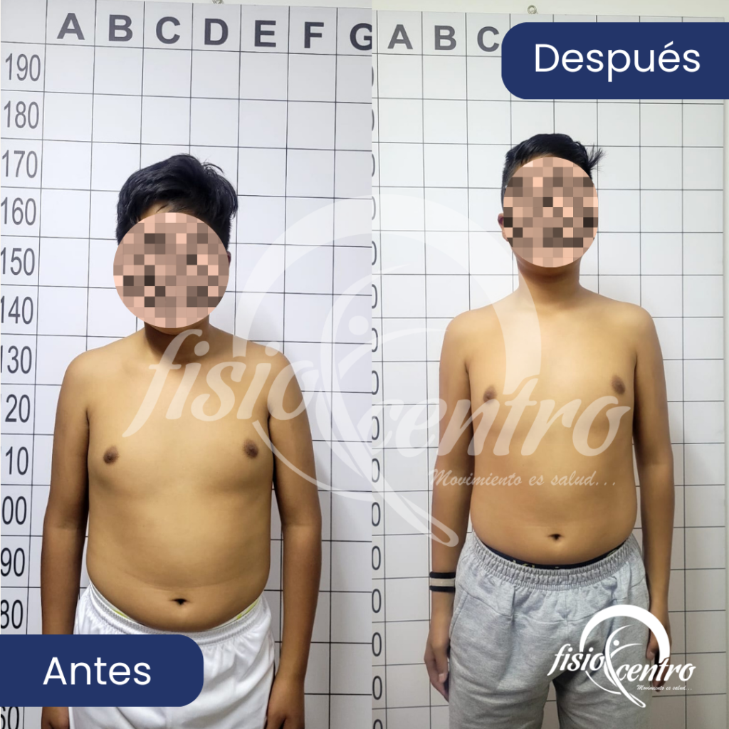 Corrección postural