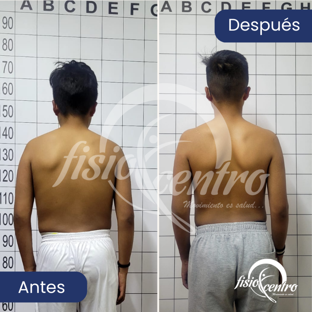 Corrección postural