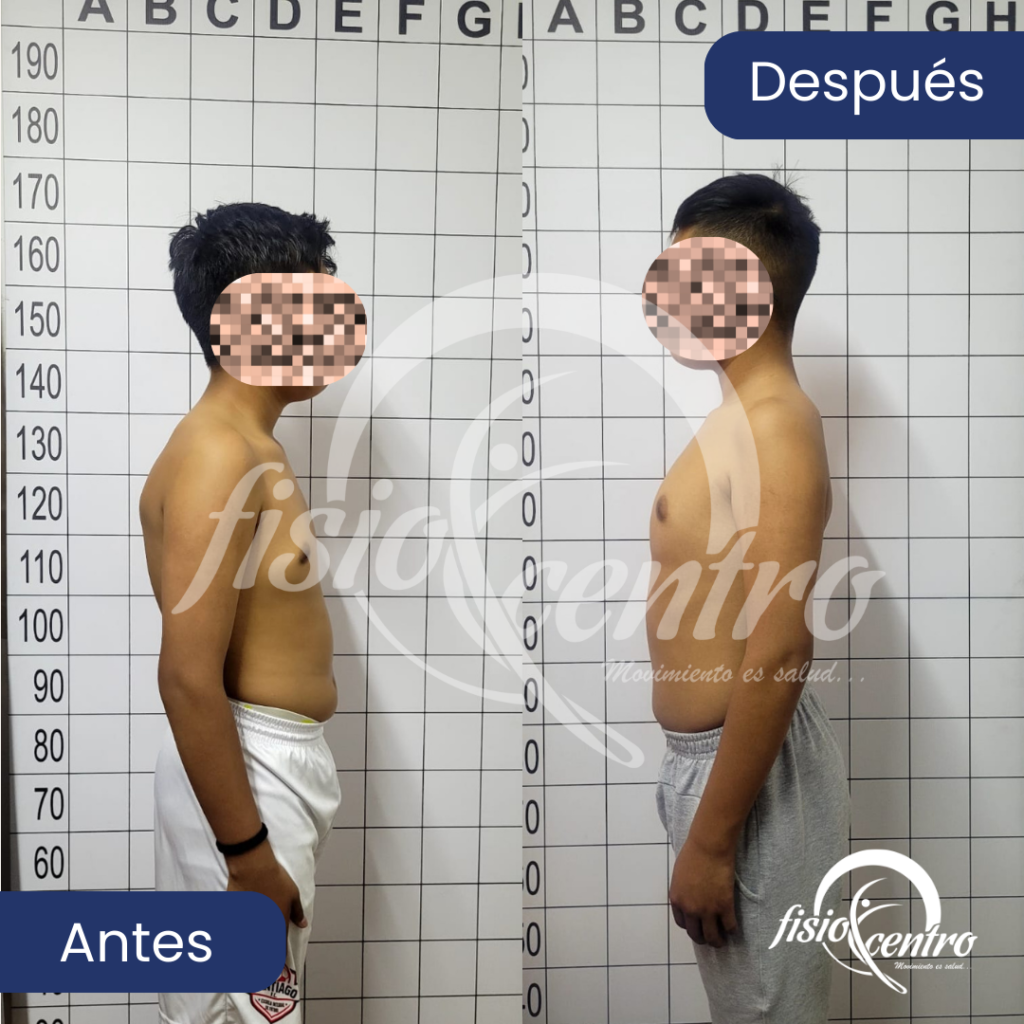 Corrección postural